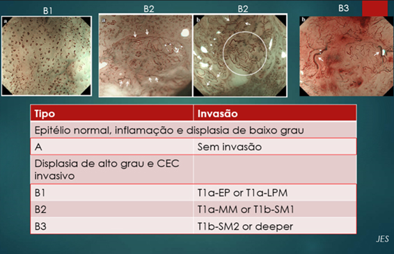 ONIDX GSTI 001 Figura6