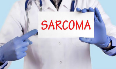 sarcoma NET OK
