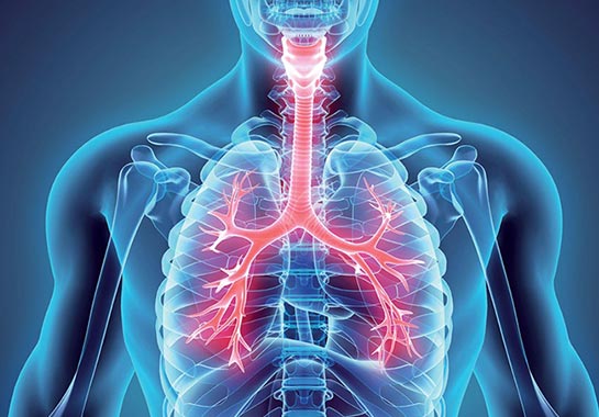 Câncer de pulmão em nunca fumantes, da epidemiologia ao panorama genômico e diretrizes de rastreio