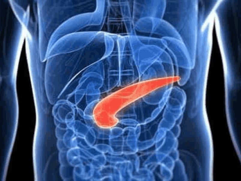 Testes genéticos germinativos permanecem subutilizados no câncer pancreático
