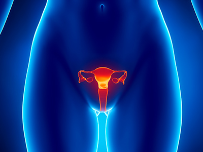Barreiras ao rastreamento do câncer do colo do útero em sete países europeus